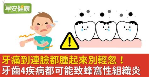 牙痛臉腫起來 水溝鼠可以養嗎